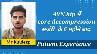 AVN hip में core decompression सर्जरी  के 6 महीने बाद / 6 months after Core decompression surgery.