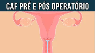 Cuidados antes e depois da Cirurgia de Alta Frequência (CAF) / LEEP / EZT -  Pré e pós operatório