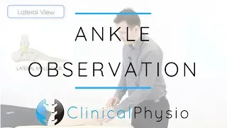 Ankle Observation | Clinical Physio Premium