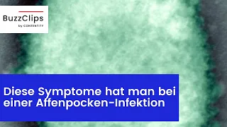 Diese Symptome hat man bei einer Affenpocken-Infektion