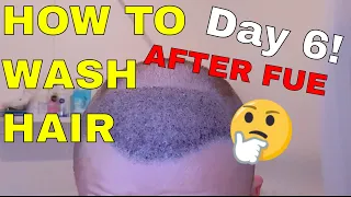 How to wash your hair after hair transplant? Day 6 of my journey! 2020