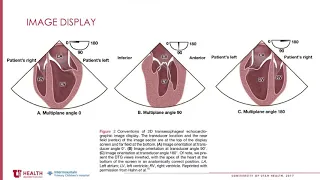 Comprehensive TEE in Children and Patients with CHD Webinar