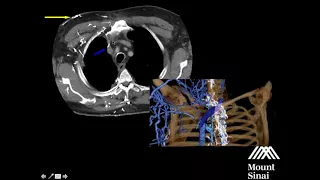 Recent Advances in Vascular Access Webinar