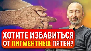 Как избавиться от пигментных ПЯТЕН на лице и теле? Причины появления. Старческие пигментные пятна.