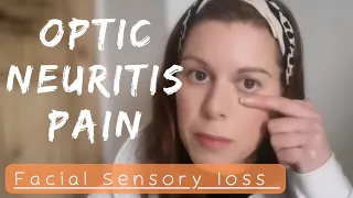 The Painful Reality of Optic Neuritis with Multiple Sclerosis