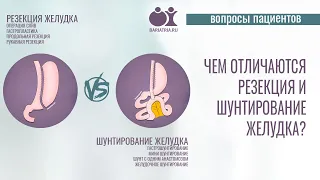 Чем отличаются резекция желудка и шунтирование желудка