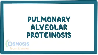 Pulmonary Alveolar Proteinosis, PAP (NORD)