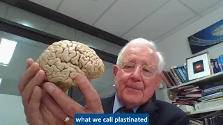 How does dementia affect the brain? - Sir Richard Faull