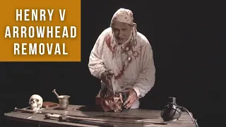 Henry V arrowhead removal | Medieval Surgery