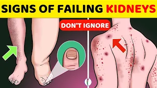 10 WARNING SIGNS THAT YOUR KIDNEYS ARE FAILING (SYMPTOMS OF A KIDNEY DISEASE YOU DON'T KNOW ABOUT)