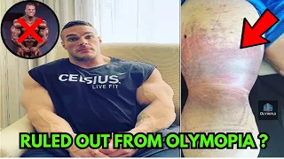 NICK WALKER OUT OF MR OLYMPIA 2023 DUE TO HAMSTRINGS