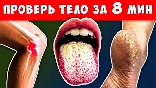 Ваше тело Просит вас о Помощи! 22 тревожных Сигнала и что с этим Делать...