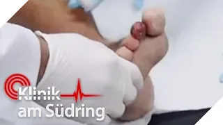 Zeh wird amputiert! Er hatte keine Lust seine Füße zu pflegen! | Klinik am Südring | SAT.1 TV