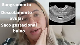 5 semanas de gravidez, descolamento ovular com sangramento + saco gestacional baixo.