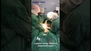 КАК ПРОХОДЯТ РОДЫ|SCALPEL.MED