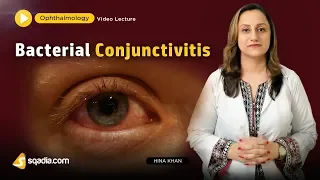 Bacterial Conjunctivitis | Ophthalmology Video Lecture | Medical Student V-Learning