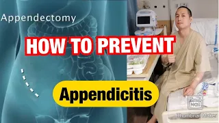 Paano maiiwasan ang Appendicitis, Naoperahan ako sa Apendix