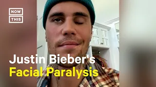 Justin Bieber Announces He Has Ramsay Hunt Syndrome