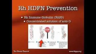 Dosing Rh Immune Globulin