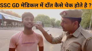 SSC GD में दाँत कैसे चेक होते हैं ? ... by indrajeet Singh