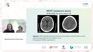 Острый инфаркт миокарда и ишемический инсульт: возможна ли реперфузионная терапия? к.м.н. Хало Н.В.