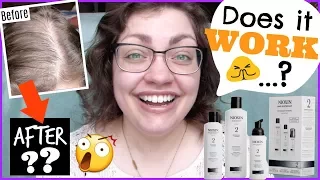 GOING BALD!? | 6 Months Using NIOXIN For Noticeably Thinning Hair