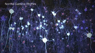 Gamma Waves Enhance the Brain’s Immune System to Treat Mice with Alzheimer’s disease.