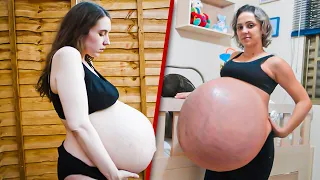 Top 10 Unusual Pregnancies That Broke Records