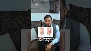 ¿Cuál es la indicación para realizarse la Circuncisión? Te dejo la respuesta en el video.