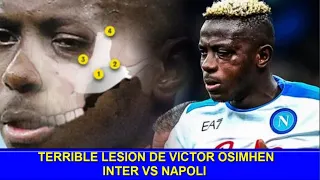 🔥 TERRIBLE LESION DE VICTOR OSIMHEN INTER VS NAPOLI