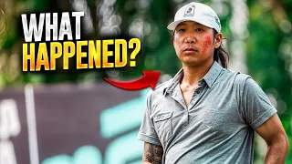 What happened to Anthony Kim's face? | Liv Golf news