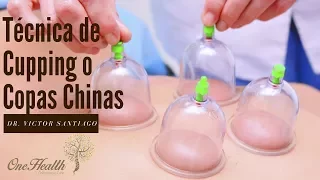 Técnica de Cupping o Copas Chinas - Dr. Víctor Santiago