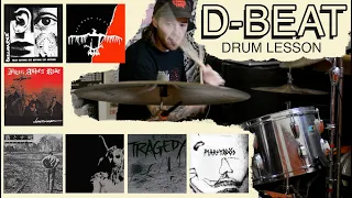 D-Beat Drum Lesson