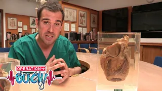 Melon-Sized Heart! | #Clip | TV Show for Kids | Operation Ouch