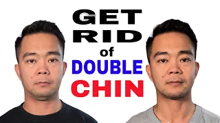 How to Get Rid of Double Chin