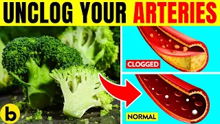 19 Delicious Foods That Naturally UNCLOG Your Arteries