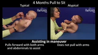 4 Month Old Baby Typical & Atypical Development Side by Side