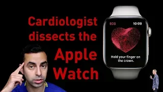 Cardiologist’s scientific analysis of the Apple Watch