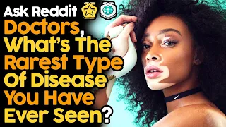 Doctors, What's The Rarest Type Of Disease You Have Ever Seen?