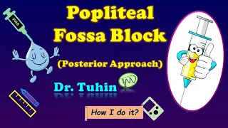 PNS guided Popliteal Sciatic Nerve Block | Intertendinous Approach | Popliteal Fossa Block