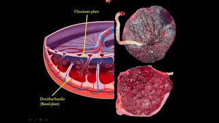 The Placenta and Umbilical Cord Ultrasound Video Lecture