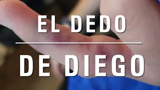 El Dedo de Diego: Basado en una Historia Real