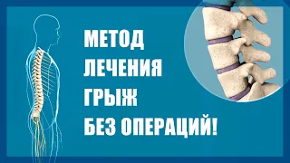 Новые методы лечения межпозвоночных грыж. Клиника лазерной хирургии Имбамед в Санкт-Петербурге.