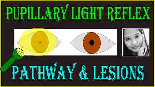 Pupillary Light Reflex – Pathway & Lesions | Neuro ophthalmology