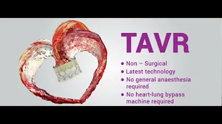 Transcatheter aortic valve implantation (TAVI)