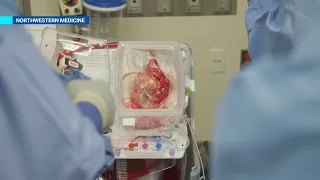 This is how 'heart in a box' technology could help heart transplant recipients
