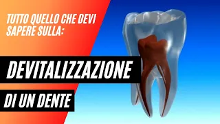 Devitalizzazione di un dente? Tutto quello che devi sapere!