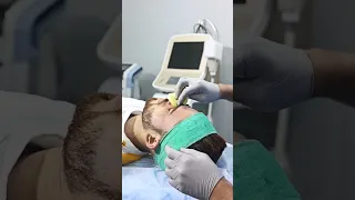 Carbon Laser Peel Treatment For Face | Skin Glow Treatment | Skinaa Clinic #viral #shorts #ytshorts