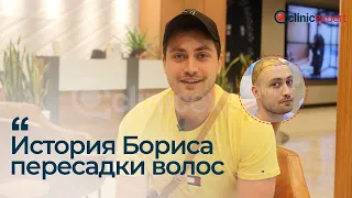 История пациента которого приехал для пересадки волос в Стамбул #Клиникэксперт