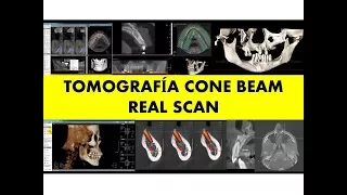 "TOMOGRAFÍA CONE BEAM" por el Dr. Luis Diaz